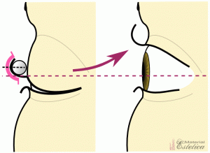 Incorrect : forme de rouleau permanente des cils