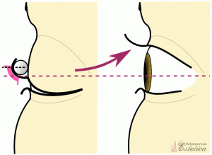 appliquer le gel jusqu’au centre horizontal du bigoudi permanente des cils
