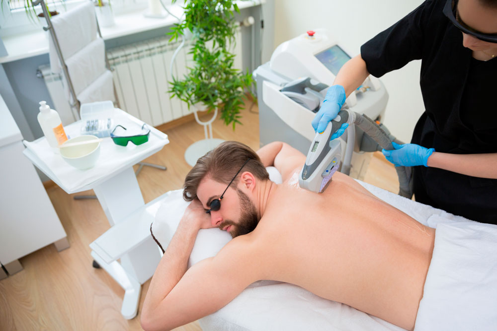Épilation laser: Vérités et mythes