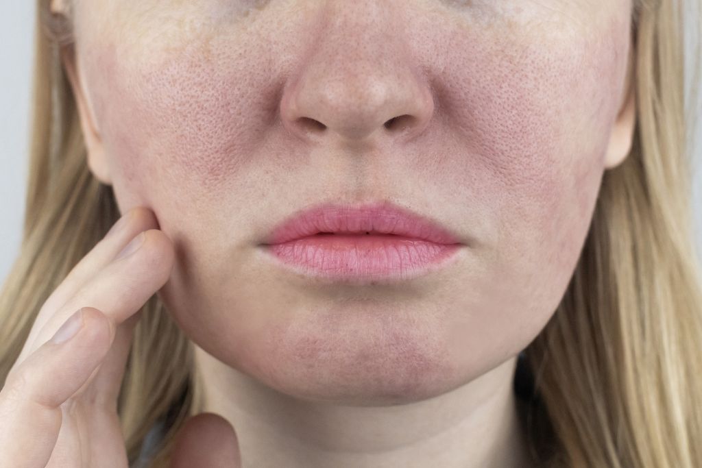 La meilleure routine visage pour peau grasse. Connaissez votre peau et prenez-en soin