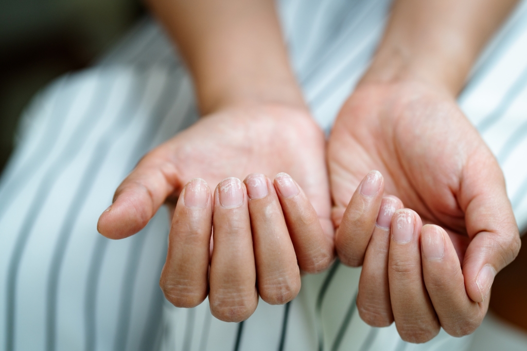 Comment fortifier les ongles abîmés : conseils, causes et soins